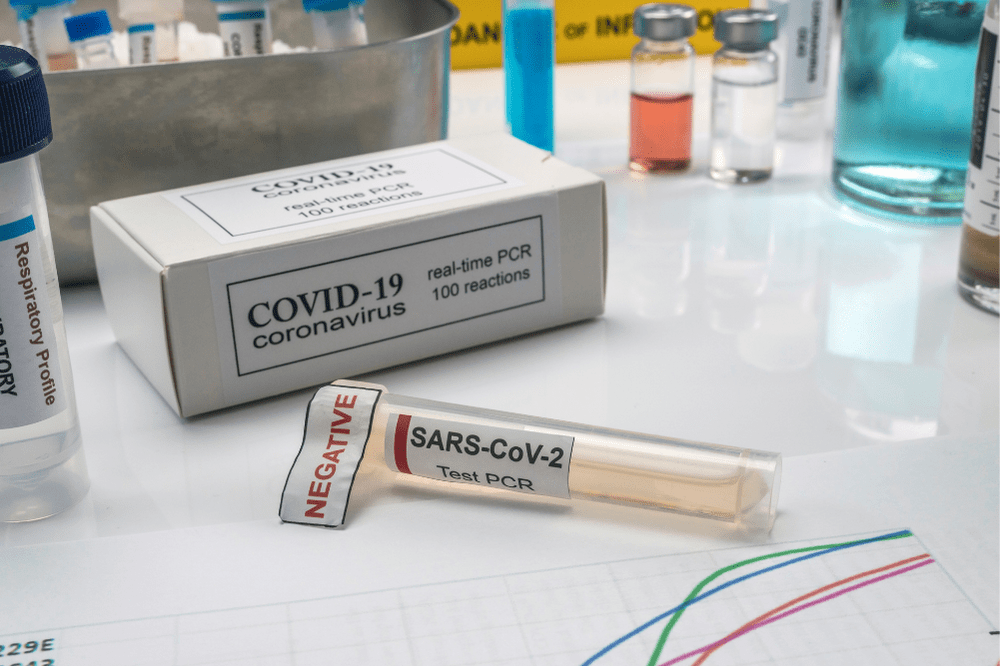 A Covid-19 PCR test